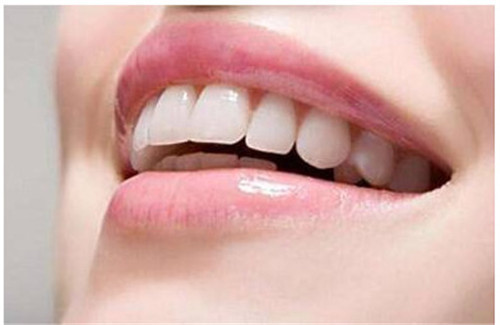石家庄美国3I种植牙对身体健康有什么影响